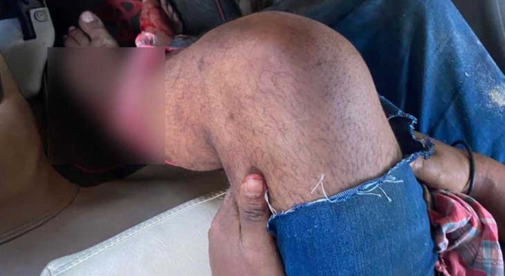 পল্লবীতে ৫ কোটি টাকা চাঁদা না দেয়ায় ব্যবসা প্রতিষ্ঠানে হামলা, গুলিবিদ্ধ ১