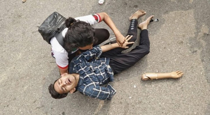 আমার এক হাত নাই, কৃত্রিম হাতটাও ওরা ভেঙে ফেলেছে