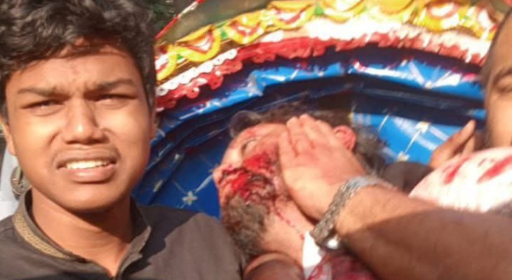 ইনকিলাব মঞ্চের আহ্বায়ক ওসমান হাদী গুলিবিদ্ধ, নেওয়া হয়েছে ঢাকা মেডিকেলে