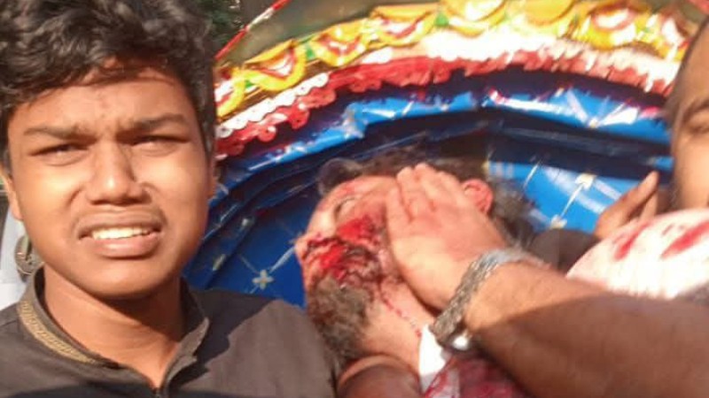 ইনকিলাব মঞ্চের আহ্বায়ক ওসমান হাদী গুলিবিদ্ধ, নেওয়া হয়েছে ঢাকা মেডিকেলে