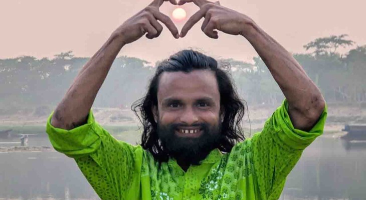 পেট্রোল দিয়ে কনটেন্ট বানাতে গিয়ে অগ্নিদগ্ধ কনটেন্ট ক্রিয়েটর আল-আমিন