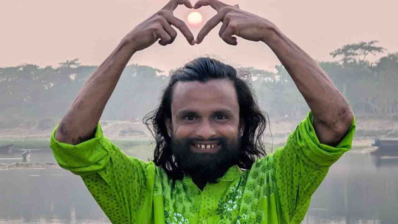 পেট্রোল দিয়ে কনটেন্ট বানাতে গিয়ে অগ্নিদগ্ধ কনটেন্ট ক্রিয়েটর আল-আমিন