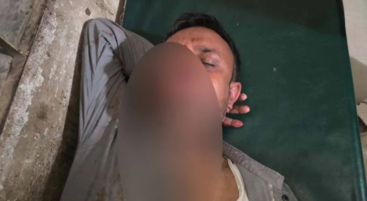 নারায়ণগঞ্জের ফতুল্লায় যুবলীগ কর্মীর ছুরিকাঘাতে জামায়াতের ওয়ার্ড সভাপতি আহত